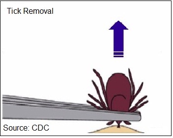 Illustration on how to remove a tick, tweezers at the base of tick's head and pull straight up/out